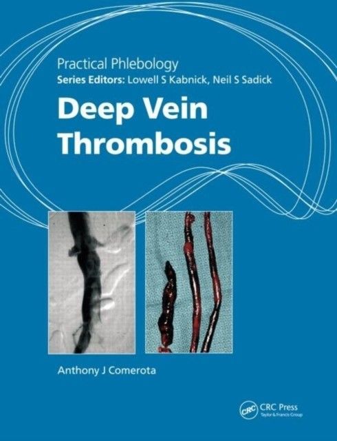 Practical Phlebology main product photo