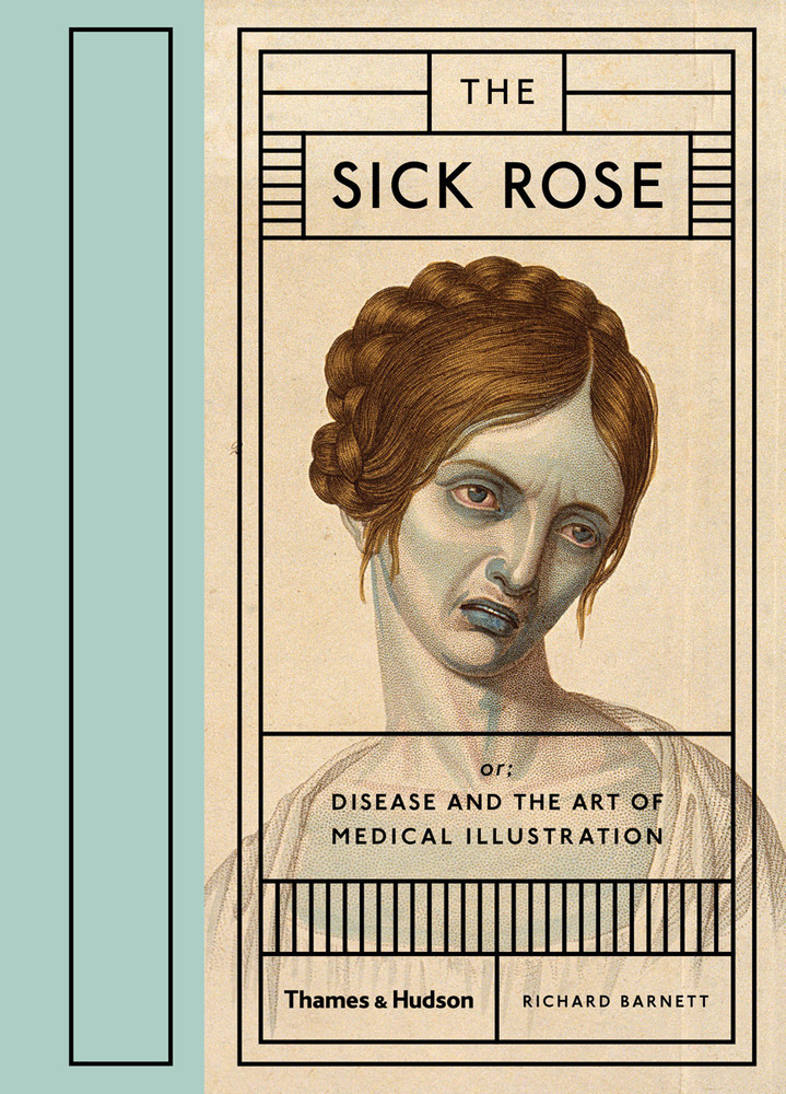 The Sick Rose main product photo
