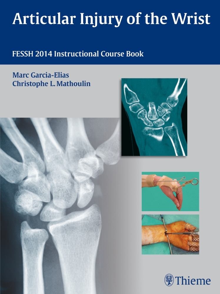 Articular Injury of the Wrist main product photo