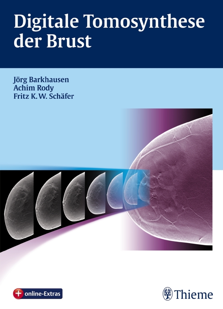 Digitale Tomosynthese der Brust main product photo