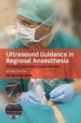 Ultrasound Guidance in Regional Anaesthesia: Principles and practical implementation