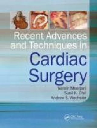 Cardiac Surgery