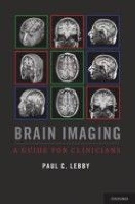 Brain Imaging: A Guide for Clinicians
