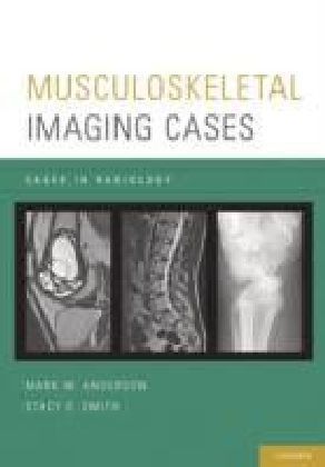 Musculoskeletal Imaging Cases