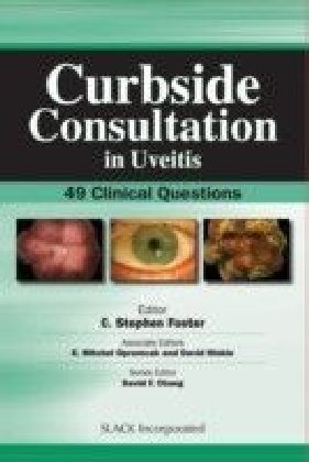 Curbside Consultation in Uveitis