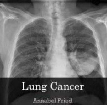Lung Cancer