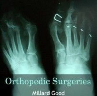 Orthopedic Surgeries