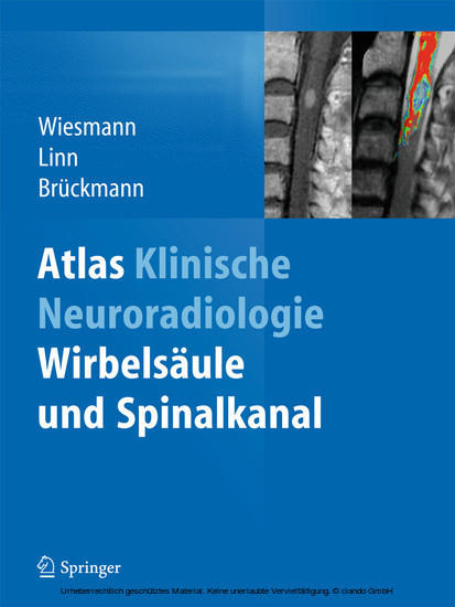 Atlas Klinische Neuroradiologie main product photo