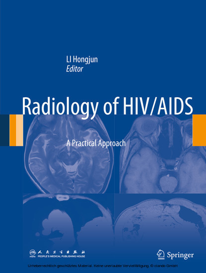 Radiology of HIV/AIDS main product photo