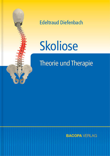 Skoliose main product photo