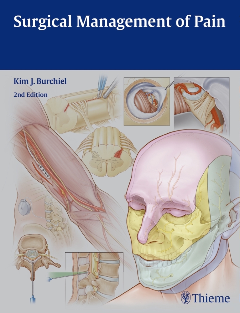 Surgical Management of Pain main product photo