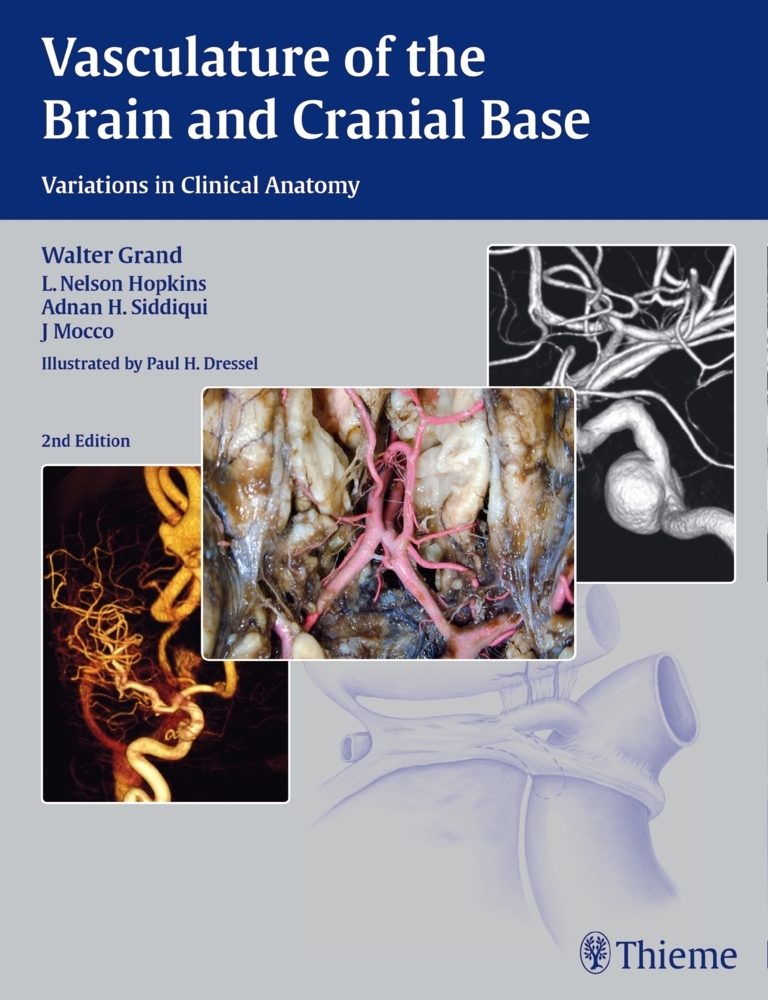 Vasculature of the Brain and Cranial Base main product photo
