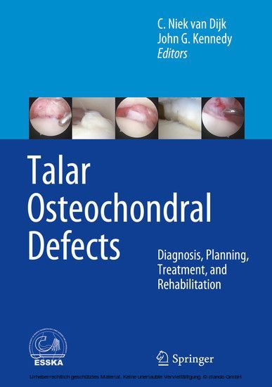 Talar Osteochondral Defects main product photo