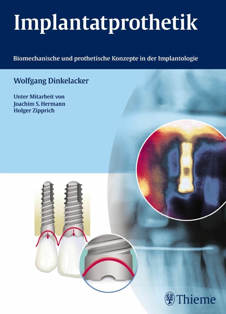 Implantatprothetik main product photo