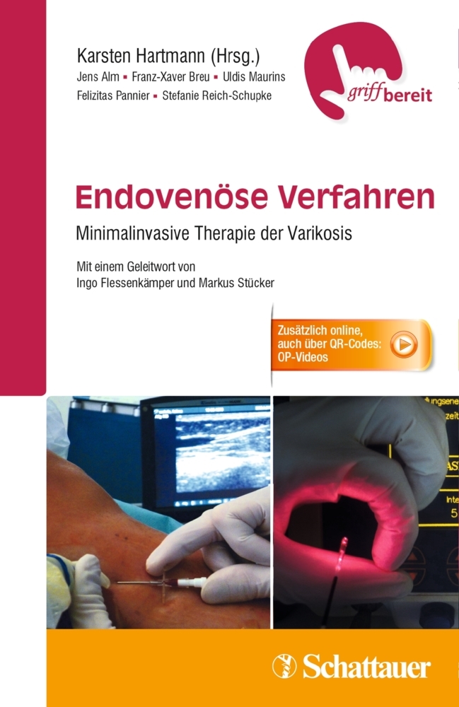 Endovenöse Verfahren main product photo