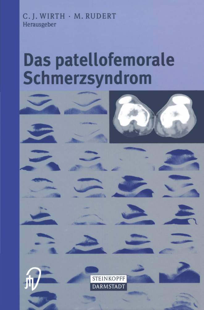 Das patellofemorale Schmerzsyndrom main product photo