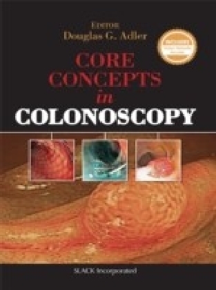 Core Concepts in Colonoscopy