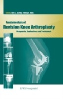 Fundamentals of Revision Knee Arthroplasty