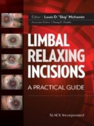 Limbal Relaxing Incisions
