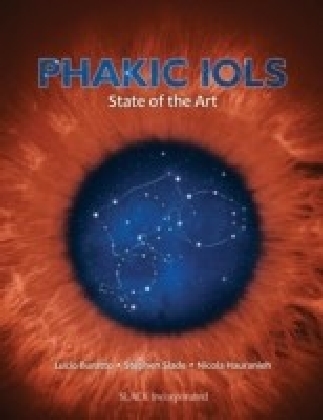 Phakic IOLs main product photo