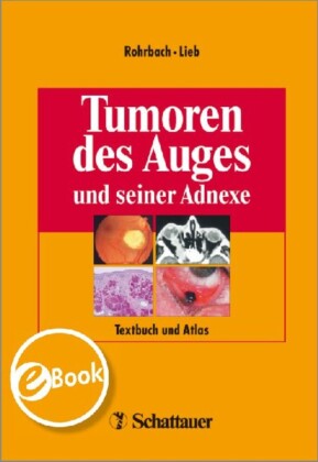 Tumoren des Auges und seiner Adnexe
