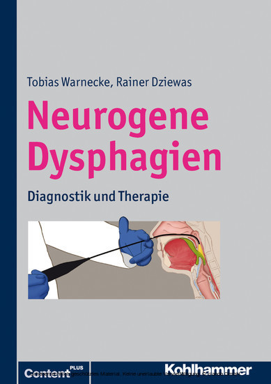 Neurogene Dysphagien main product photo