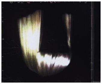 1000 Forms Of Fear, 1 Audio-CD