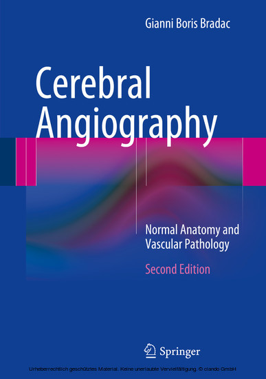 Cerebral Angiography main product photo