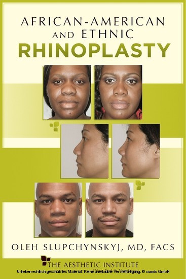 African-American and Ethnic Rhinoplasty main product photo