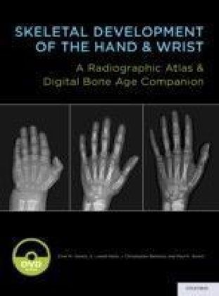 Skeletal Development of the Hand and Wrist: A Radiographic Atlas and Digital Bone Age Companion