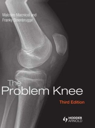 Problem Knee, Third Edition
