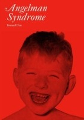 Angelman Syndrome
