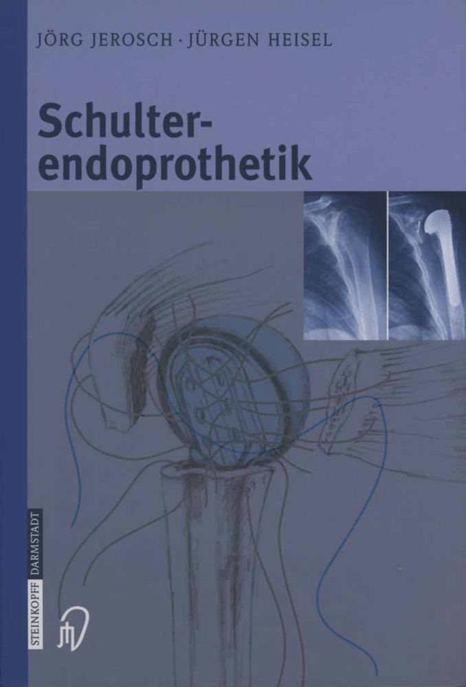 Schulterendoprothetik main product photo