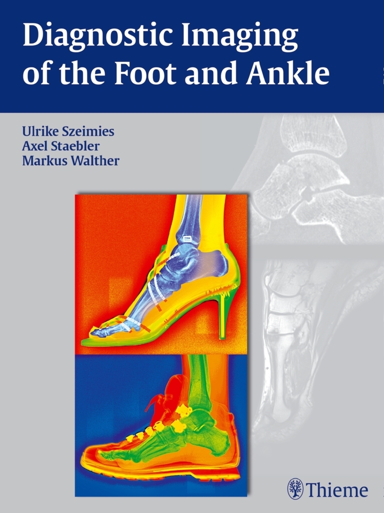 Diagnostic Imaging of the Foot and Ankle main product photo