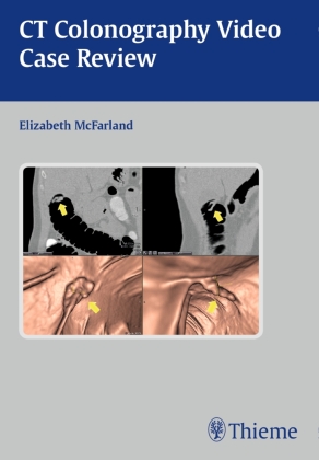 Clinical Case Review of CT Colonography, CD-ROM