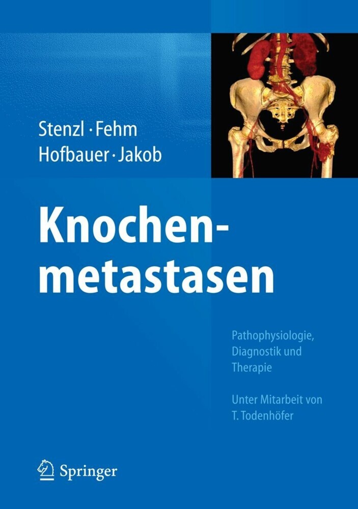 Knochenmetastasen main product photo