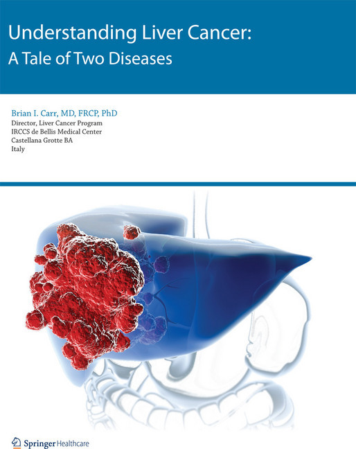 Understanding Liver Cancer main product photo