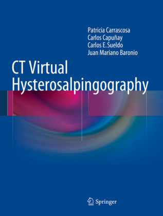 CT Virtual Hysterosalpingography