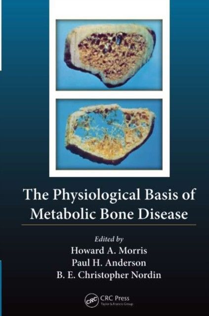 Physiological Basis of Metabolic Bone Disease main product photo