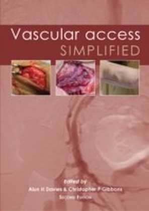 Vascular Access Simplified; second edition