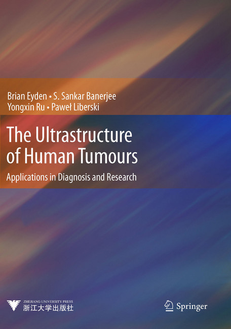 The Ultrastructure of Human Tumours main product photo