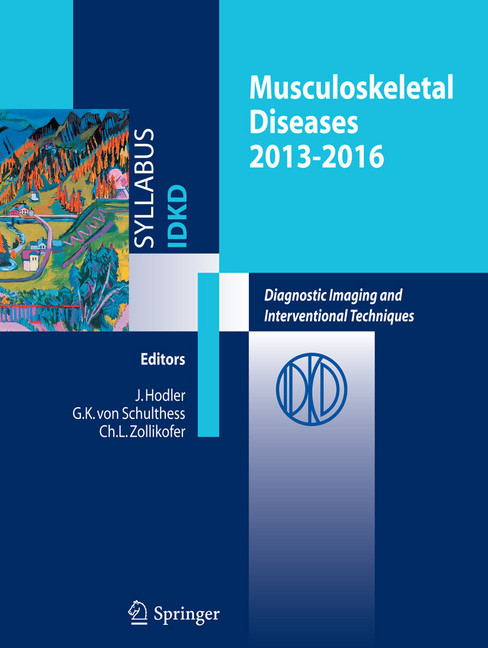 Musculoskeletal Diseases 2013-2016 main product photo