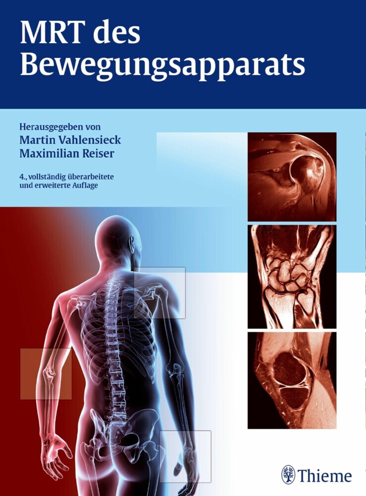 MRT des Bewegungsapparats main product photo