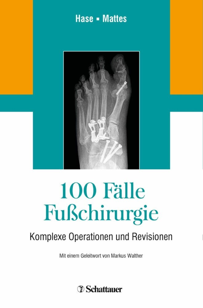 100 Fälle Fußchirurgie main product photo