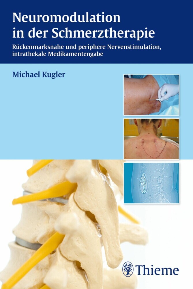 Neuromodulation in der Schmerztherapie main product photo