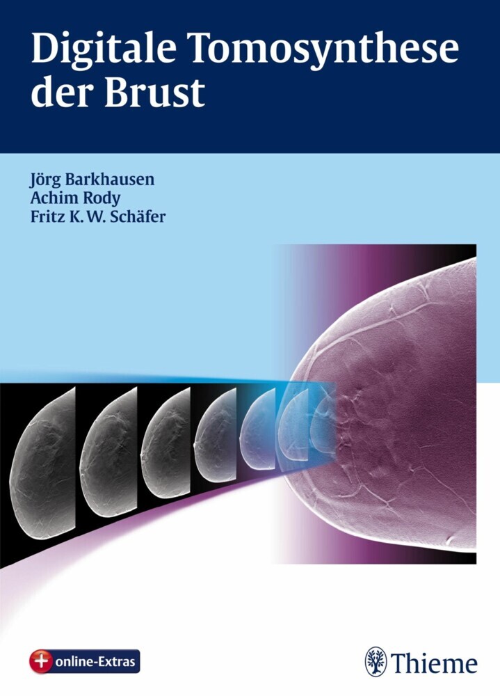 Digitale Tomosynthese der Brust main product photo