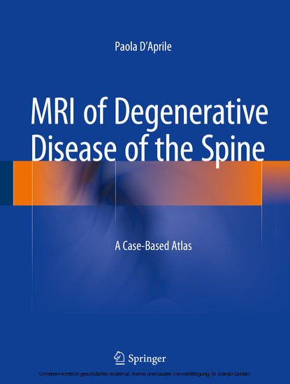MRI of Degenerative Disease of the Spine main product photo
