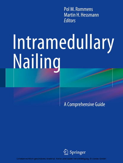 Intramedullary Nailing main product photo