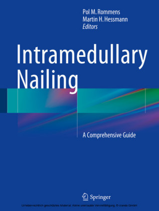 Intramedullary Nailing