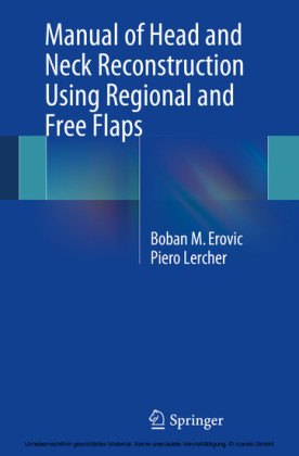 Manual of Head and Neck Reconstruction Using Regional and Free Flaps